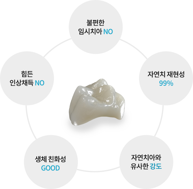 올세라믹 장점